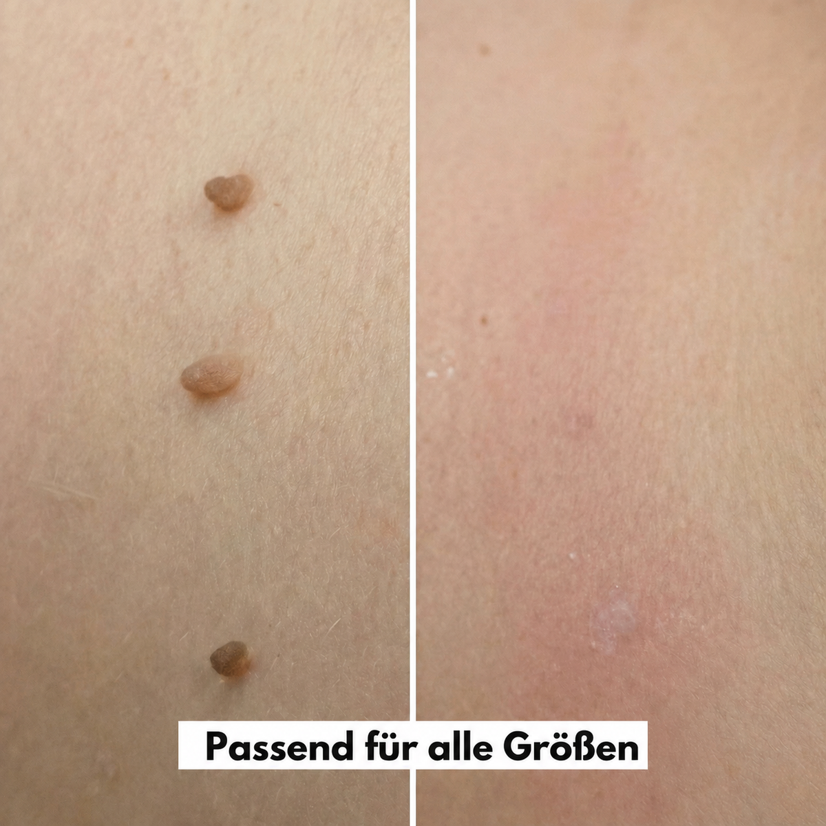 MediClear Plus™ Wieder Wohlfühlen in Deiner Haut